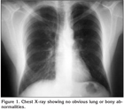 Primary sternal tuberculosis mimicking anterior chest wall tumor: a ...